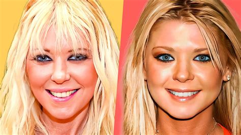 tara reid plastic surgery|Tara Reid Feels ‘Great’ After Getting a Smile Makeover